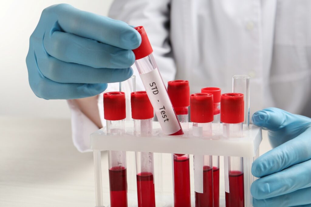 Top-Notch STD Testing Near Me in Allen, Texas