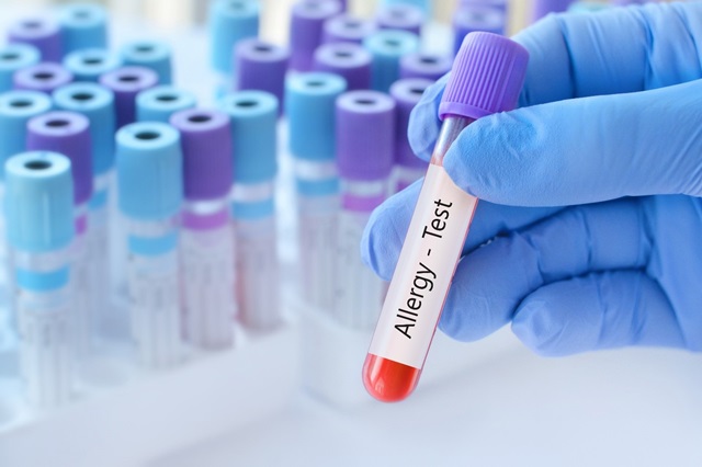 Trusted Allergy Testing in Allen TX